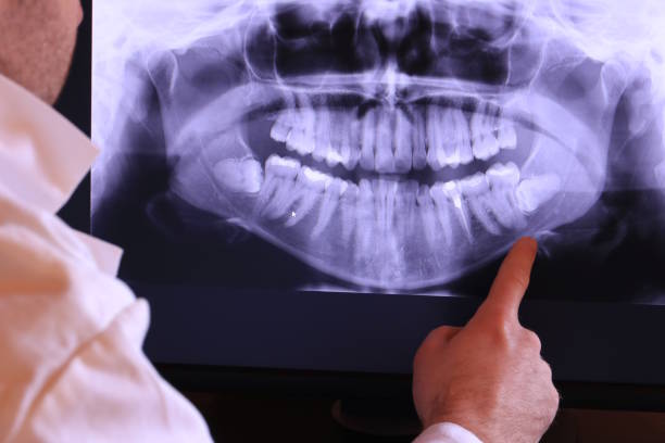 Best Emergency Dental Extractions in Longview, WA