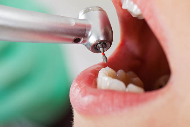 Best Emergency Dental Services for Seniors in Longview, WA